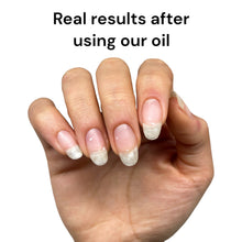 Load image into Gallery viewer, Cuticle Growth Nail Oil

